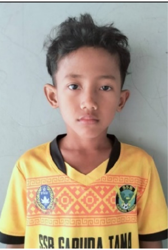 AHMAD BENZEMA RISTIAWAN